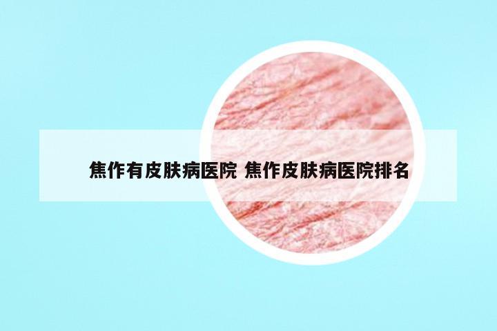 焦作有皮肤病医院 焦作皮肤病医院排名