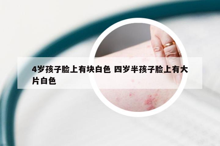 4岁孩子脸上有块白色 四岁半孩子脸上有大片白色