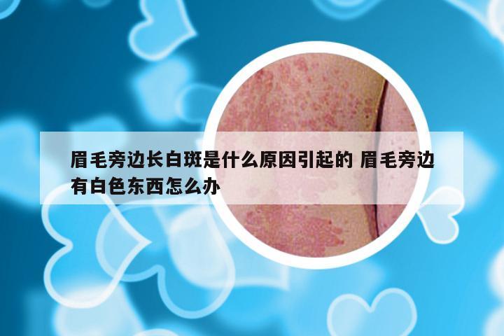 眉毛旁边长白斑是什么原因引起的 眉毛旁边有白色东西怎么办