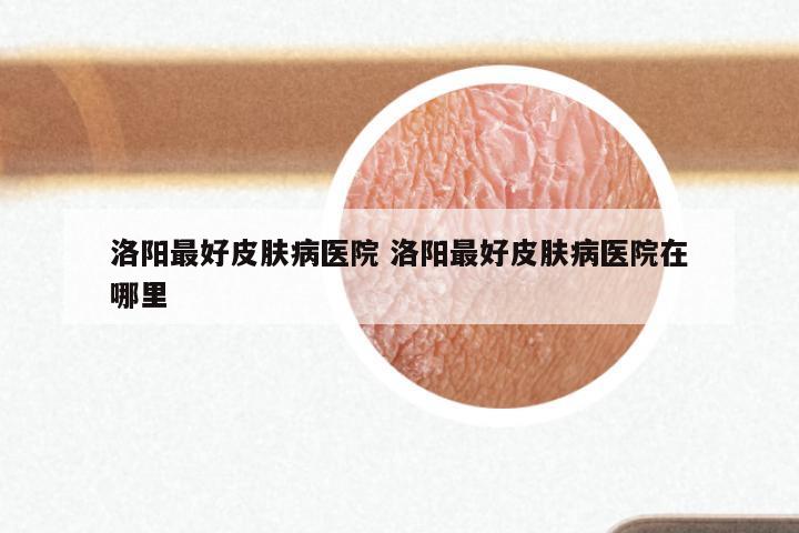 洛阳最好皮肤病医院 洛阳最好皮肤病医院在哪里