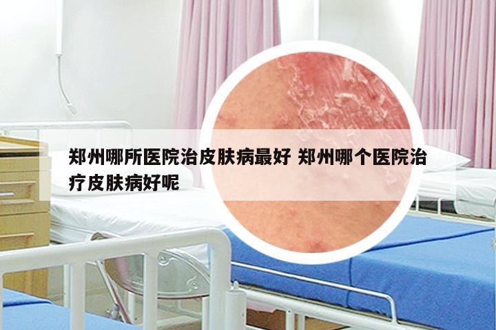 郑州哪所医院治皮肤病最好 郑州哪个医院治疗皮肤病好呢