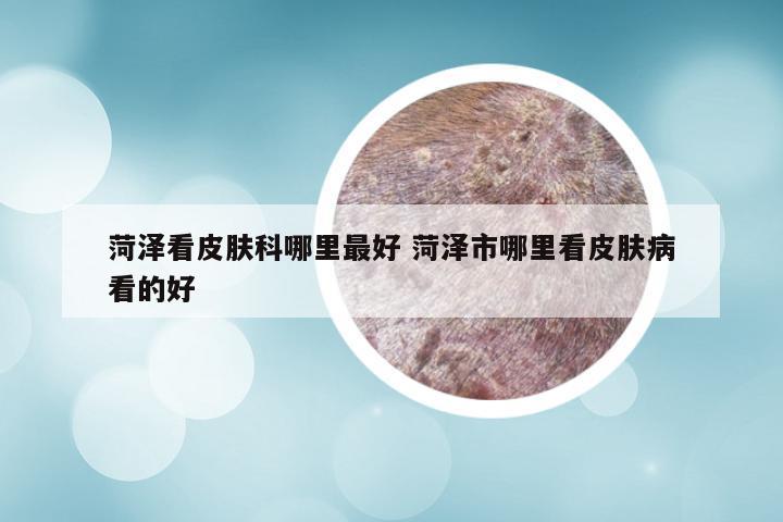 菏泽看皮肤科哪里最好 菏泽市哪里看皮肤病看的好