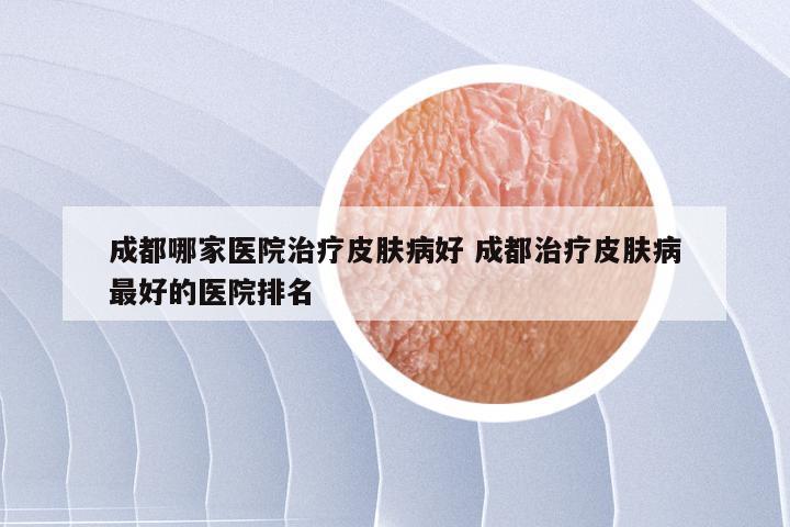 成都哪家医院治疗皮肤病好 成都治疗皮肤病最好的医院排名