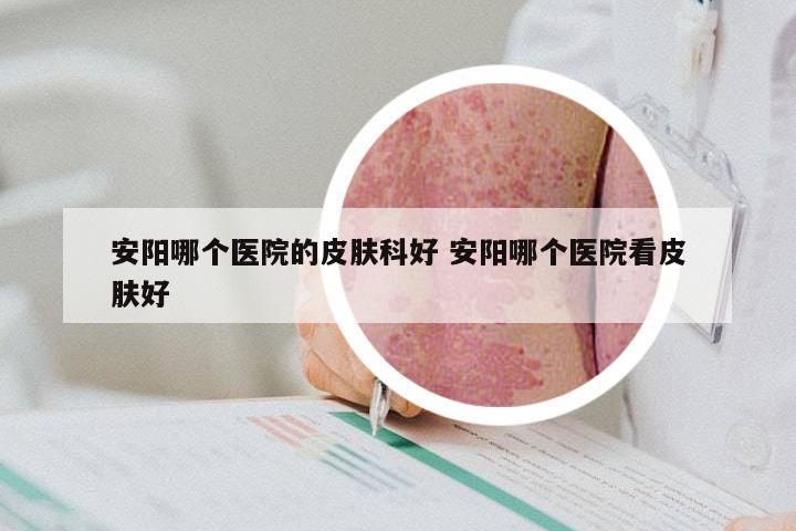 安阳哪个医院的皮肤科好 安阳哪个医院看皮肤好