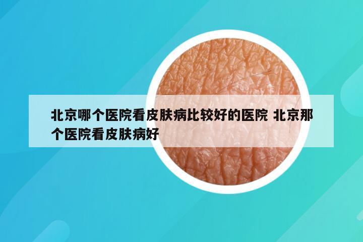 北京哪个医院看皮肤病比较好的医院 北京那个医院看皮肤病好