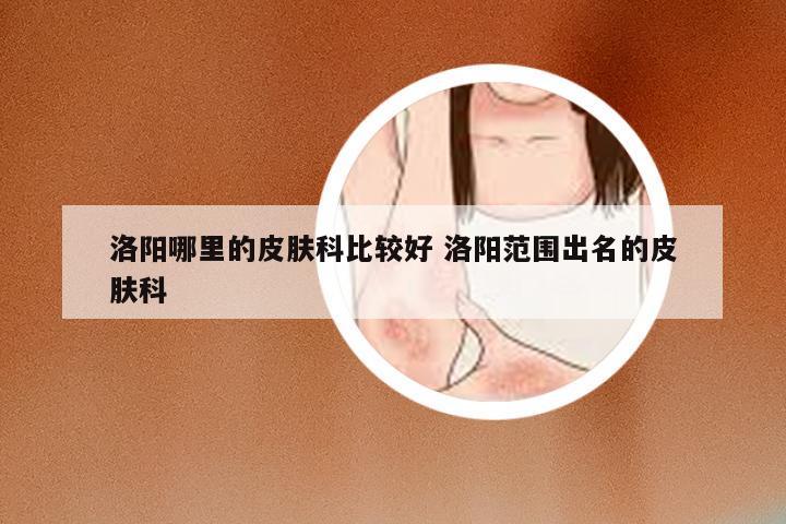 洛阳哪里的皮肤科比较好 洛阳范围出名的皮肤科
