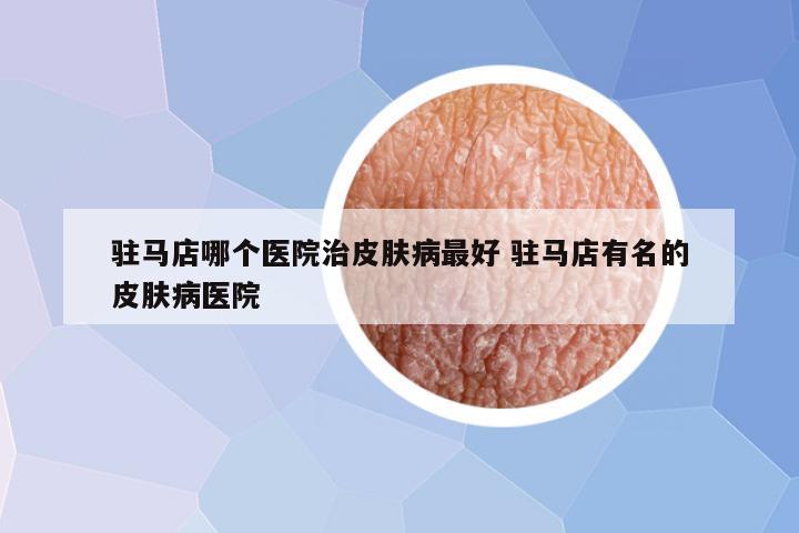 驻马店哪个医院治皮肤病最好 驻马店有名的皮肤病医院