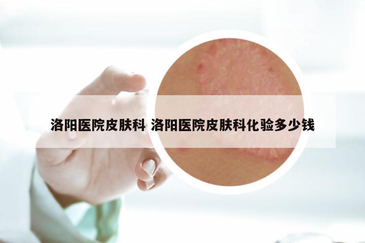 洛阳医院皮肤科 洛阳医院皮肤科化验多少钱