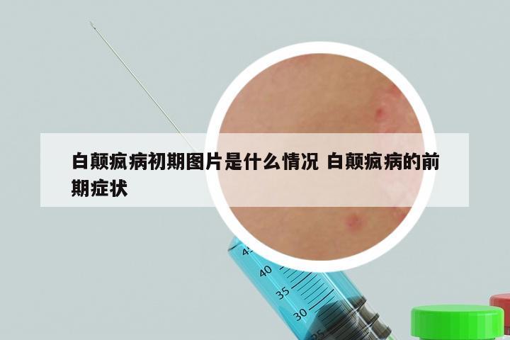 白颠疯病初期图片是什么情况 白颠疯病的前期症状