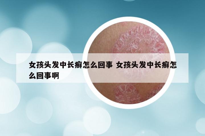 女孩头发中长癣怎么回事 女孩头发中长癣怎么回事啊