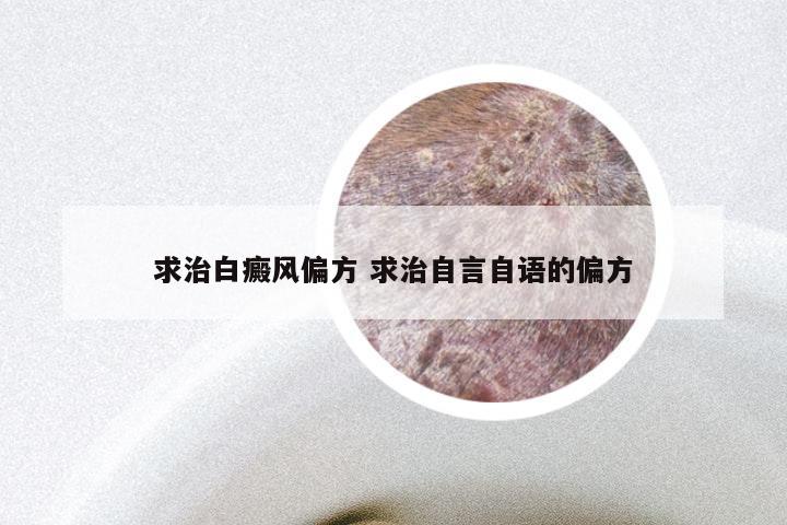 求治白癜风偏方 求治自言自语的偏方