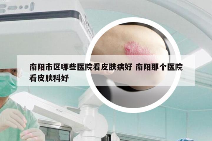 南阳市区哪些医院看皮肤病好 南阳那个医院看皮肤科好