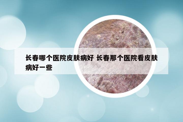 长春哪个医院皮肤病好 长春那个医院看皮肤病好一些