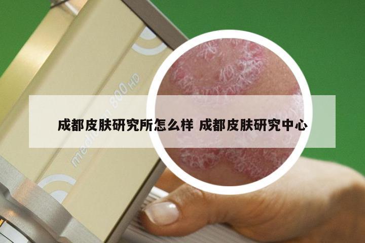 成都皮肤研究所怎么样 成都皮肤研究中心