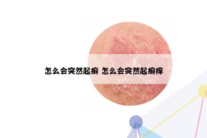 怎么会突然起癣 怎么会突然起癣痒