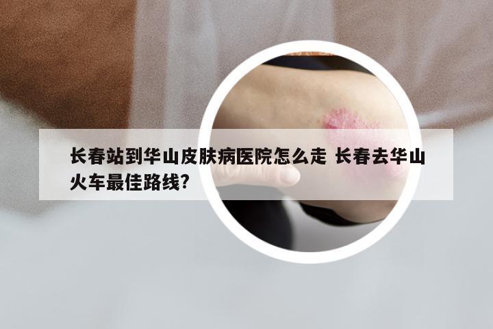 长春站到华山皮肤病医院怎么走 长春去华山火车最佳路线?