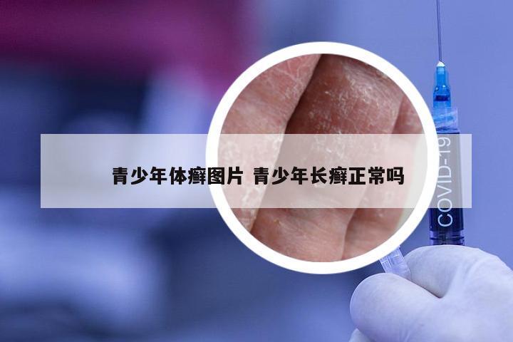 青少年体癣图片 青少年长癣正常吗