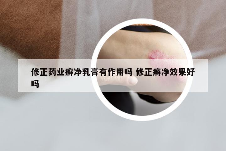 修正药业癣净乳膏有作用吗 修正癣净效果好吗