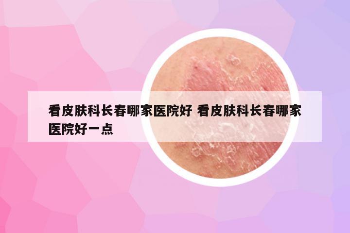 看皮肤科长春哪家医院好 看皮肤科长春哪家医院好一点