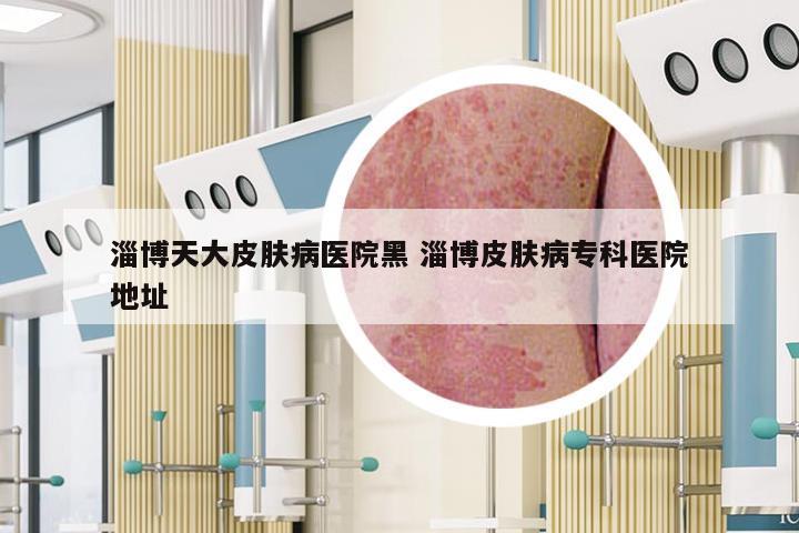 淄博天大皮肤病医院黑 淄博皮肤病专科医院地址