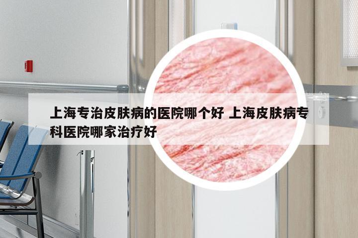 上海专治皮肤病的医院哪个好 上海皮肤病专科医院哪家治疗好
