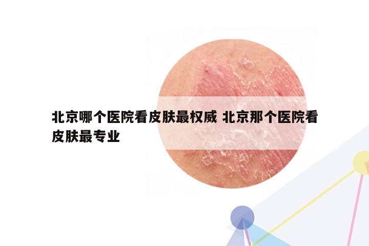 北京哪个医院看皮肤最权威 北京那个医院看皮肤最专业