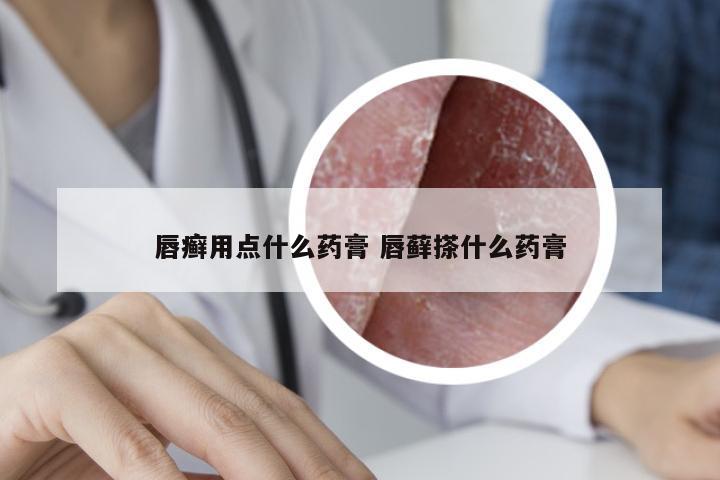 唇癣用点什么药膏 唇藓搽什么药膏