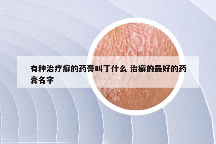 有种治疗癣的药膏叫丁什么 治癣的最好的药膏名字