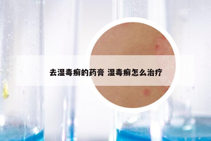 去湿毒癣的药膏 湿毒癣怎么治疗