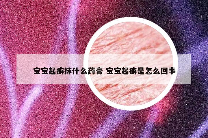 宝宝起癣抹什么药膏 宝宝起癣是怎么回事