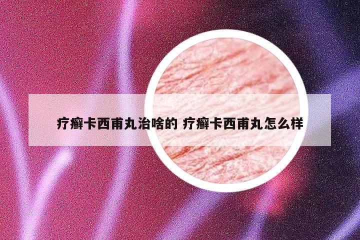 疗癣卡西甫丸治啥的 疗癣卡西甫丸怎么样