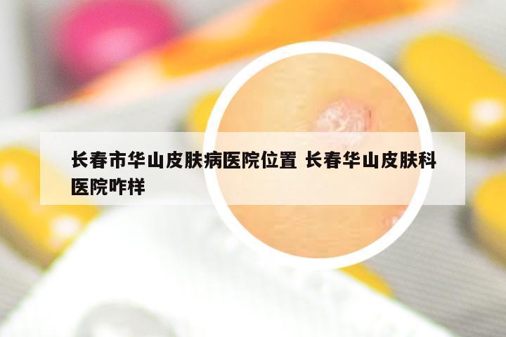 长春市华山皮肤病医院位置 长春华山皮肤科医院咋样