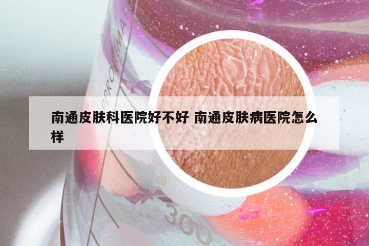 南通皮肤科医院好不好 南通皮肤病医院怎么样