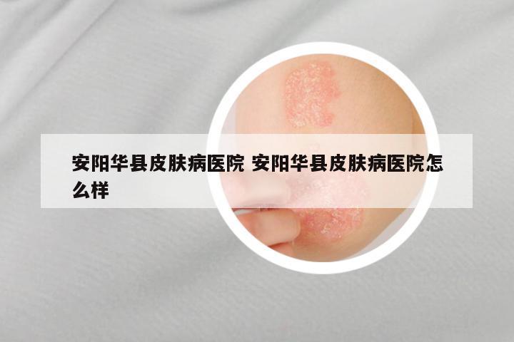 安阳华县皮肤病医院 安阳华县皮肤病医院怎么样