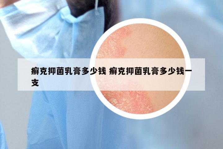 癣克抑菌乳膏多少钱 癣克抑菌乳膏多少钱一支