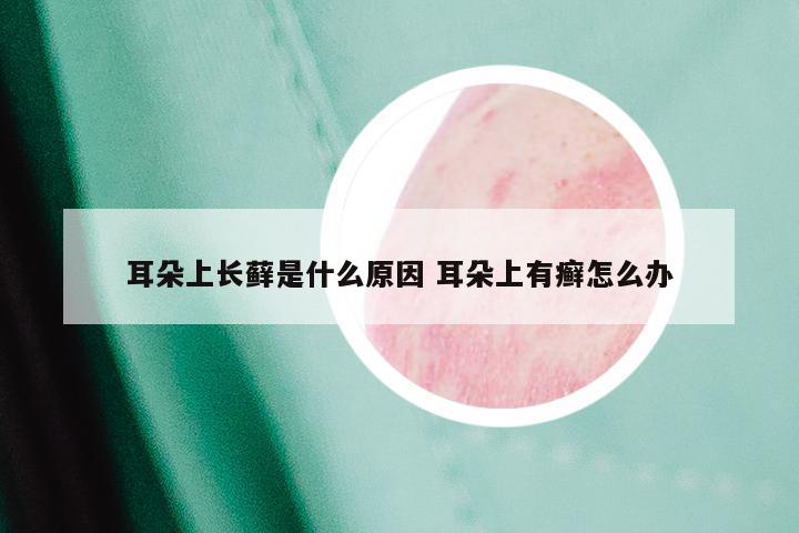 耳朵上长藓是什么原因 耳朵上有癣怎么办