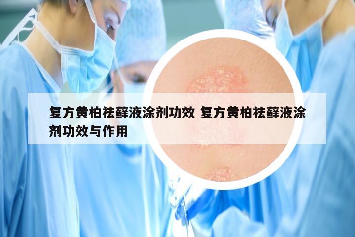 复方黄柏祛藓液涂剂功效 复方黄柏祛藓液涂剂功效与作用