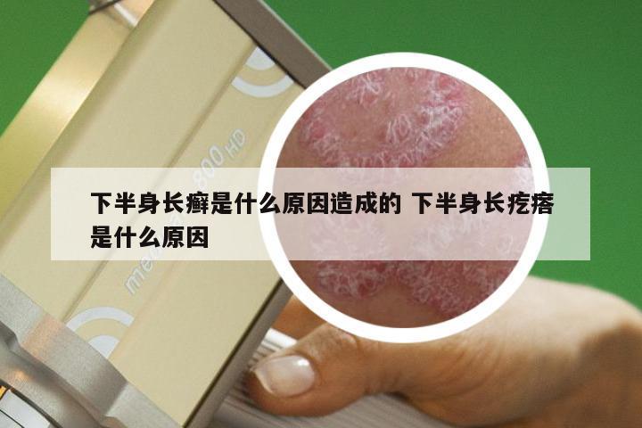 下半身长癣是什么原因造成的 下半身长疙瘩是什么原因