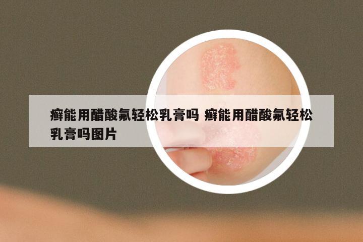 癣能用醋酸氟轻松乳膏吗 癣能用醋酸氟轻松乳膏吗图片