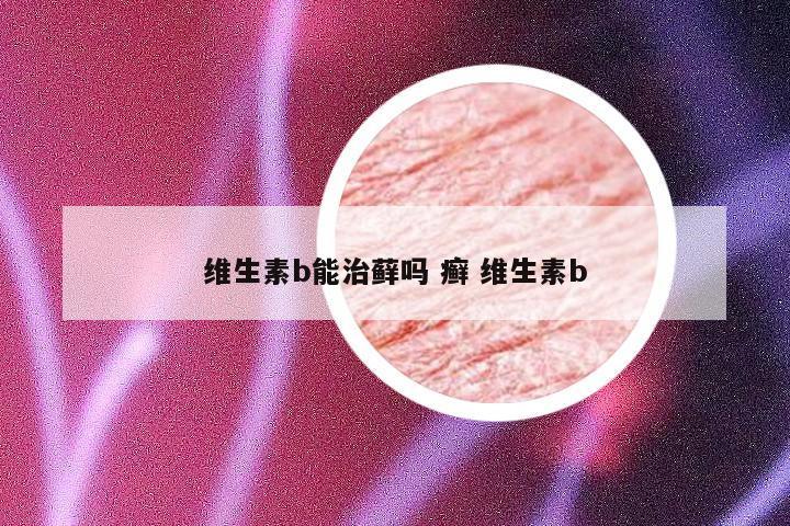 维生素b能治藓吗 癣 维生素b