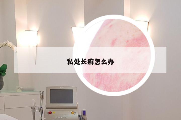 私处长癣怎么办