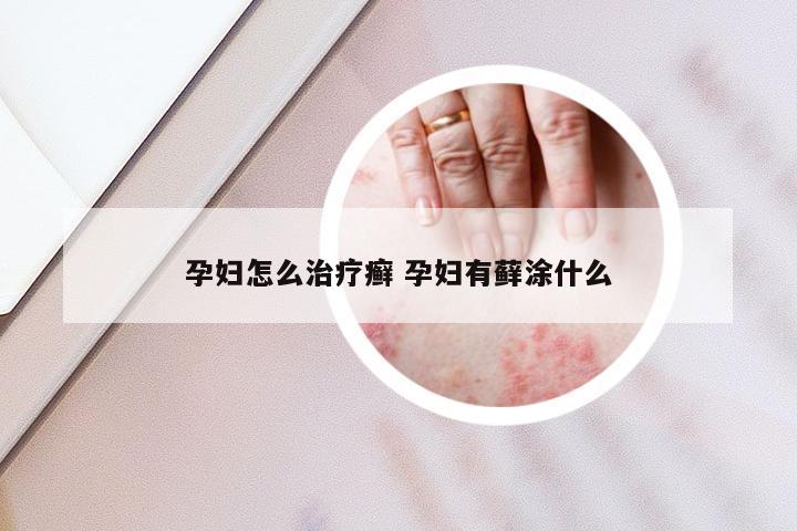 孕妇怎么治疗癣 孕妇有藓涂什么