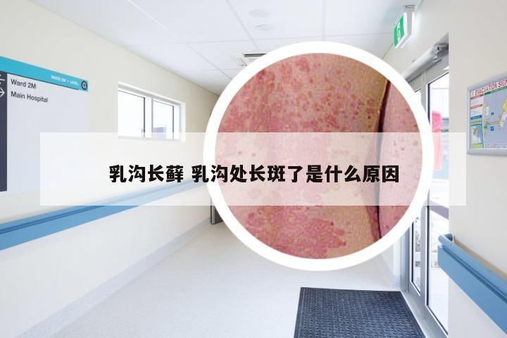 乳沟长藓 乳沟处长斑了是什么原因