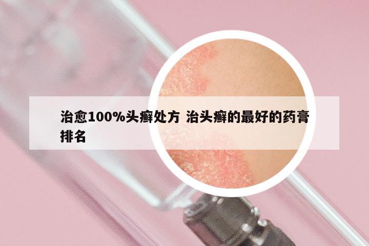 治愈100%头癣处方 治头癣的最好的药膏排名