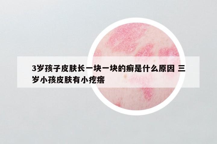 3岁孩子皮肤长一块一块的癣是什么原因 三岁小孩皮肤有小疙瘩