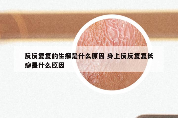 反反复复的生癣是什么原因 身上反反复复长癣是什么原因
