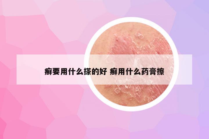 癣要用什么搽的好 癣用什么药膏擦