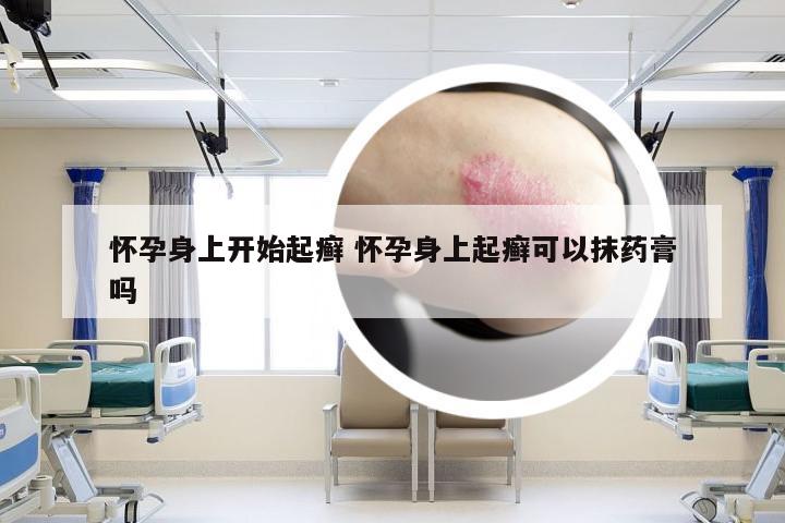 怀孕身上开始起癣 怀孕身上起癣可以抹药膏吗