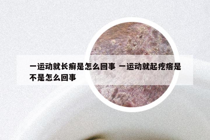 一运动就长癣是怎么回事 一运动就起疙瘩是不是怎么回事