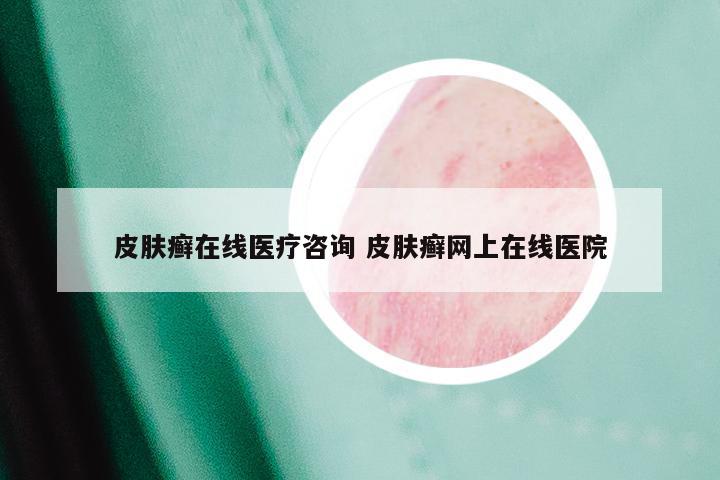 皮肤癣在线医疗咨询 皮肤癣网上在线医院